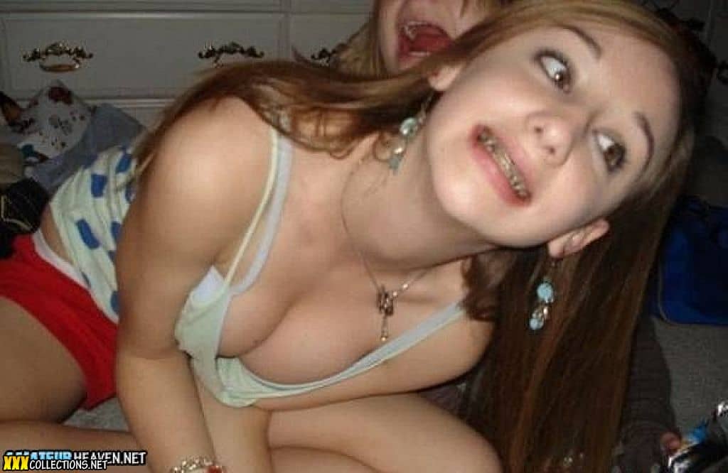 amateur teen braces nude 